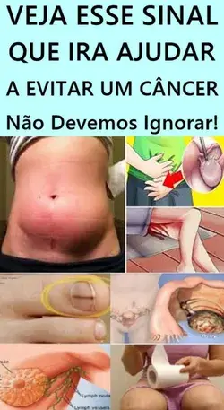 Fique atento: 10 Sinais que podem indicar câncer que não devemos ignorar.