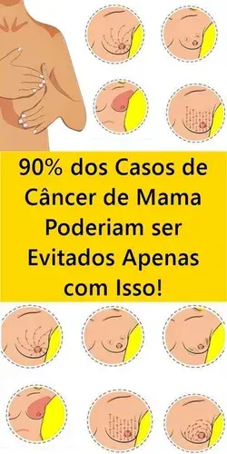 90% dos Casos de Câncer de Mama Poderiam ser Evitados com Isso!