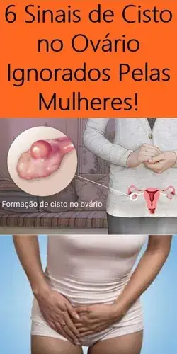 Sinais de Cisto no Ovário Ignorados Pelas Mulheres