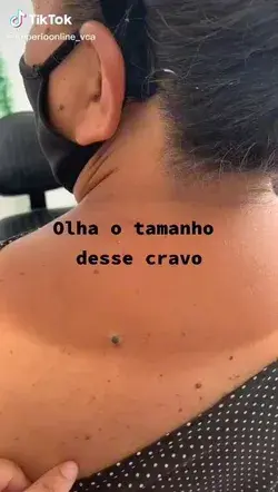 chocada, olha só o tamanho desse cravo