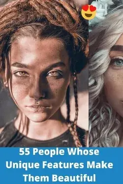 55 People Whose Unique Features Make Them Beautiful