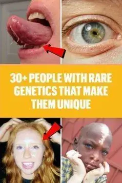 People With Rare Features That Make Them Unique