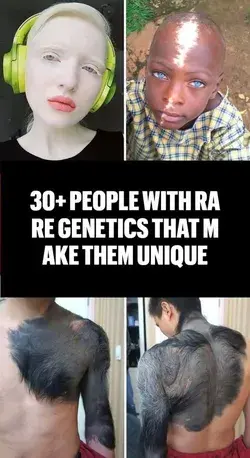 30+ People With Rare Genetics That Make Them Unique