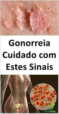 Sinais de Açúcar no Sangue que Jamais Devemos Ignorar em Hipótese Alguma