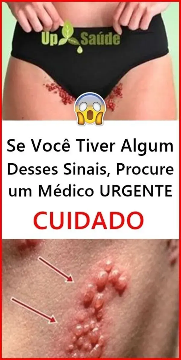 Se Você Tiver Algum Desses Sinais, Procure um Médico URGENTE!