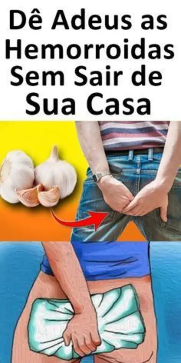 Dê Adeus às HEMORROIDAS Fazendo Apenas Isso!