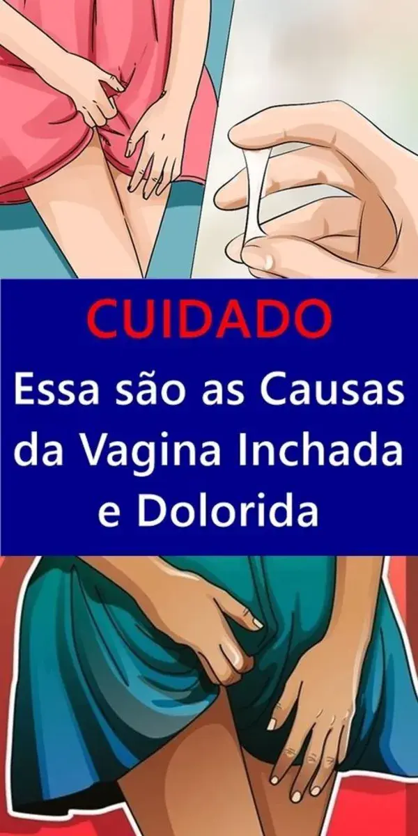 Coceira Vaginal - Como Acabar com a Coceira Intima em Apenas 1 Dia!