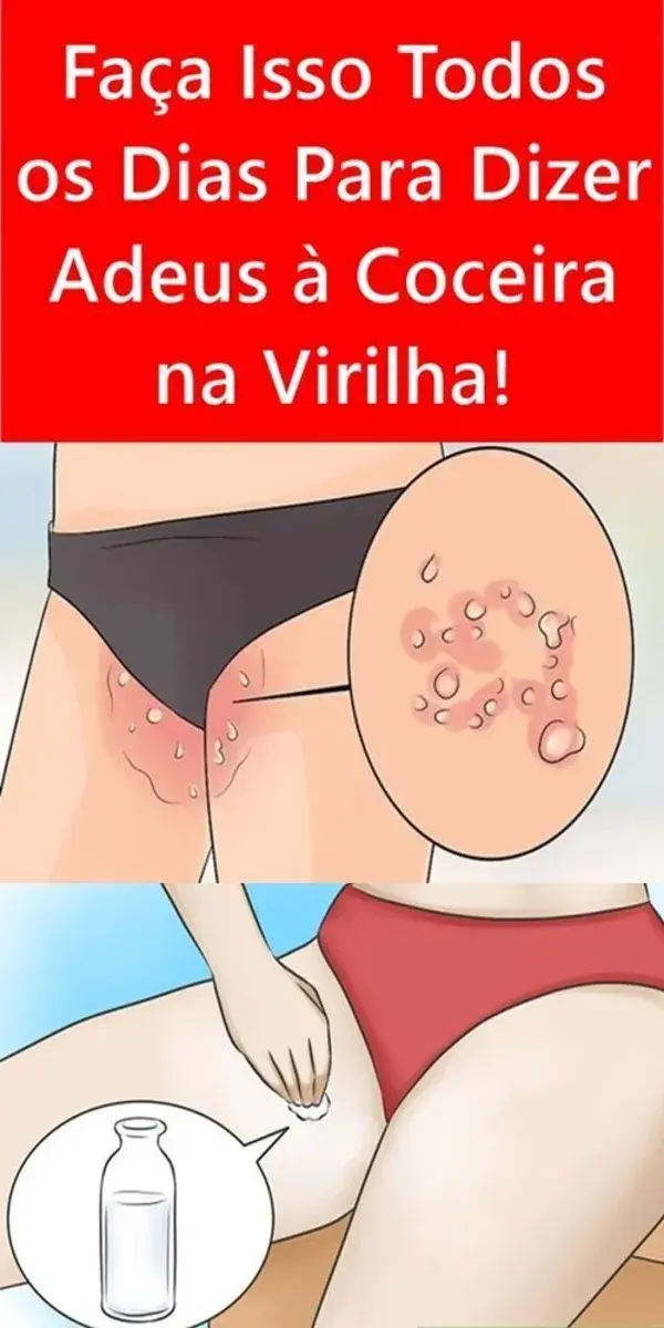 Os melhores produtos para clarear a virilha