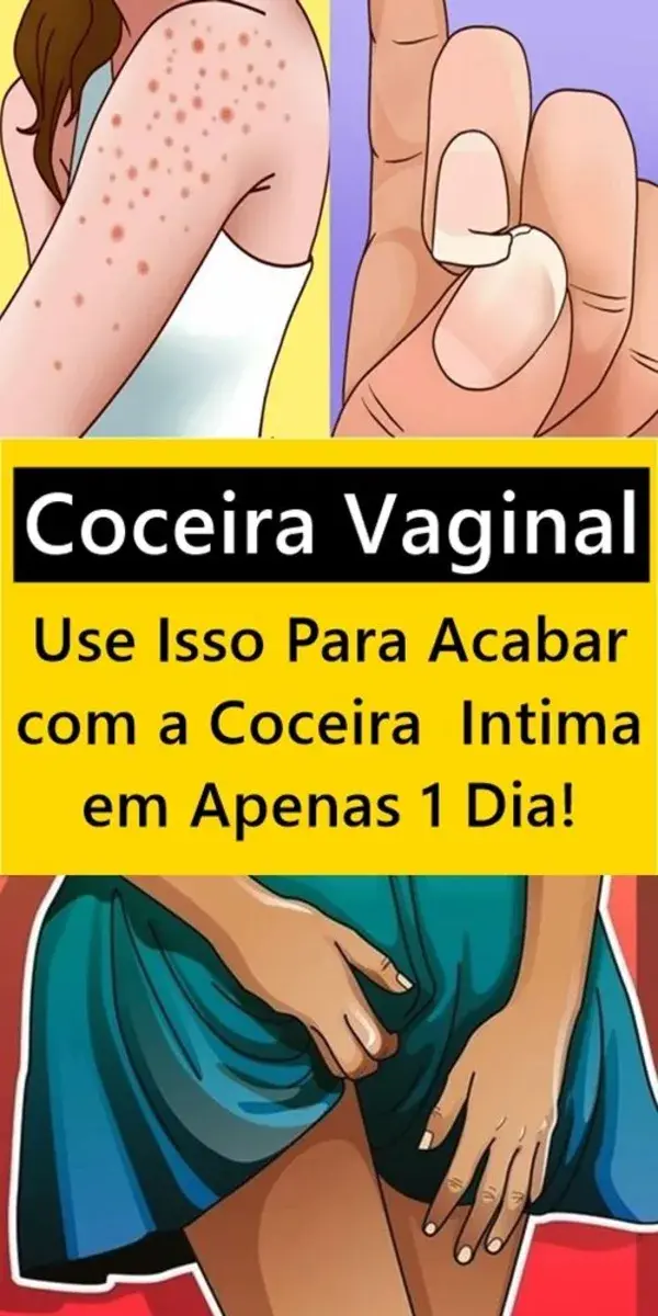 Coceira Vaginal - Como Acabar com a Coceira Intima em Apenas 1 Dia!