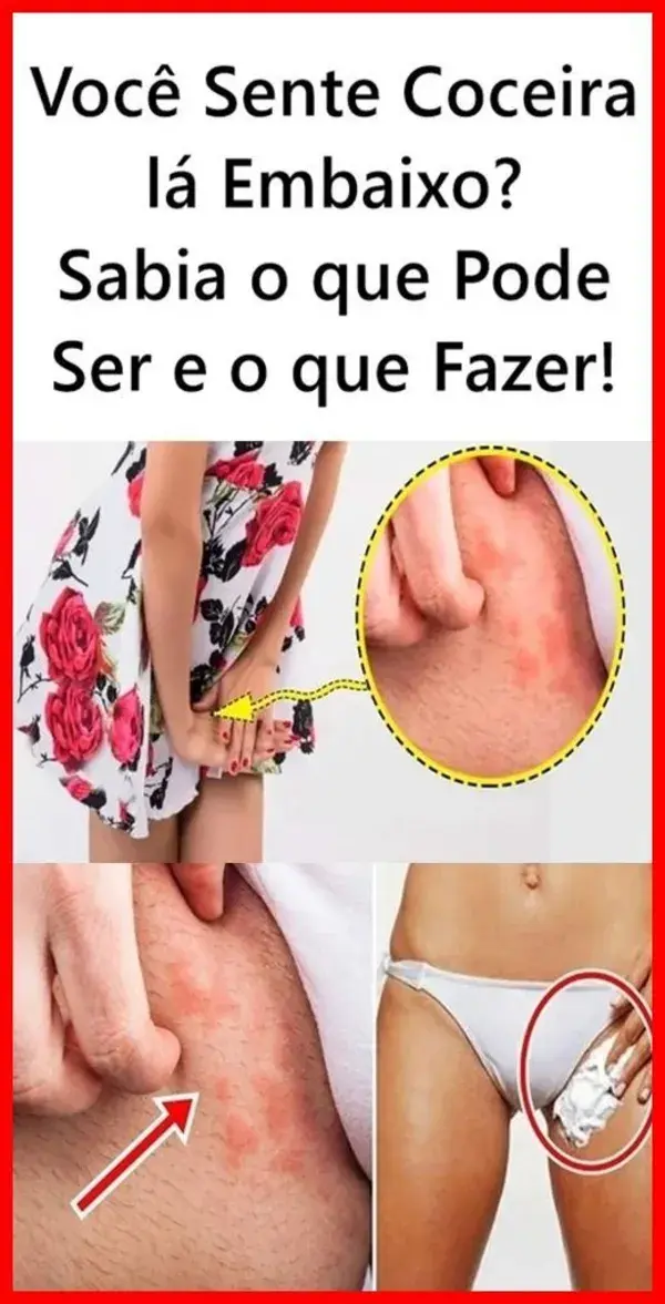 Você Sente Coceira lá Embaixo? Sabia o que Pode Ser e o que Fazer!