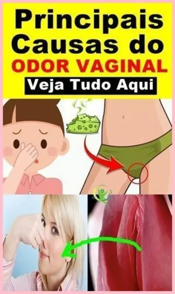 5 remedios naturales contra el mal olor vaginal