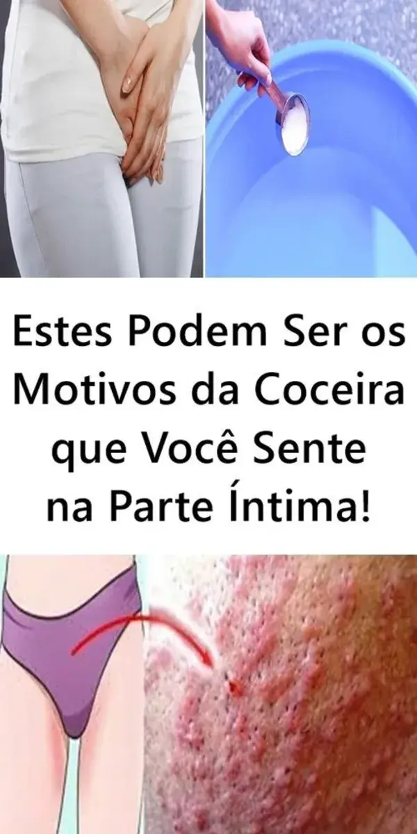 Estes Podem Ser os Motivos da Coceira que Você Sente na Parte Íntima!