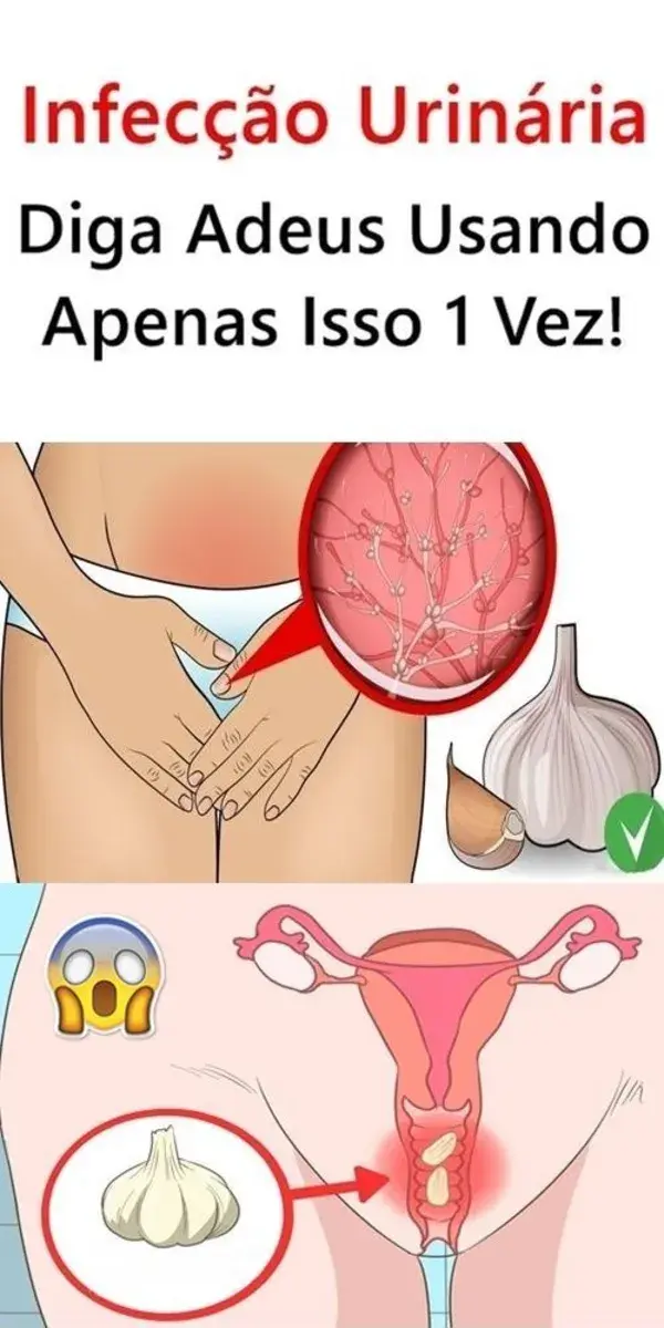 "Segredos para uma saúde intestinal impecável como mulher"