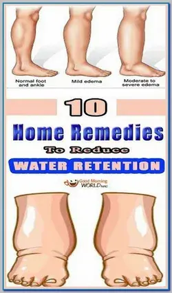 8 BEST HOME REMEDIES TO REDUCE WATER RETENTION