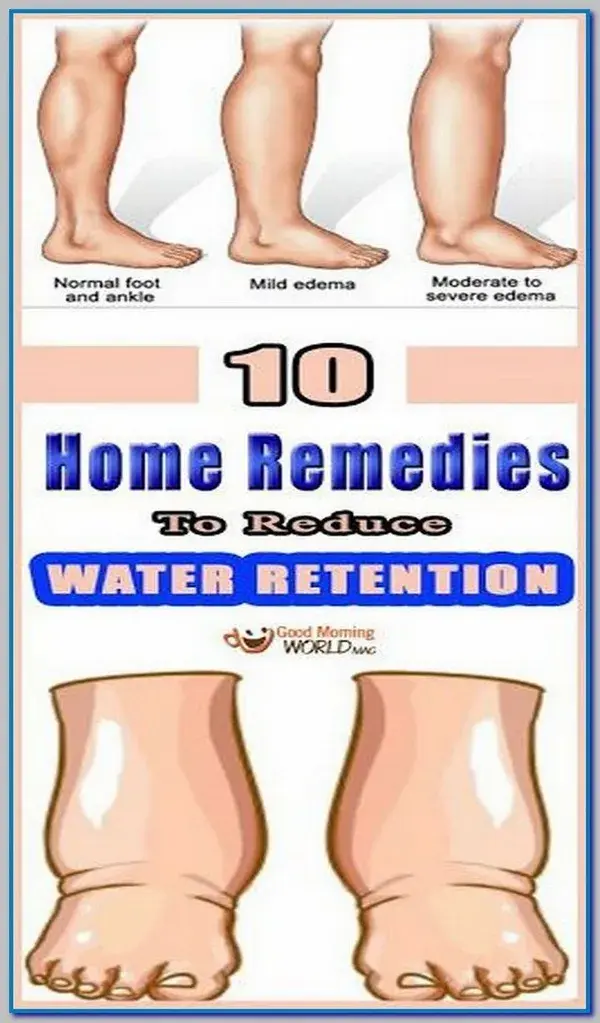 8 BEST HOME REMEDIES TO REDUCE WATER RETENTION