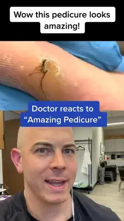 Doctor reacts to “amazing” pedicure!