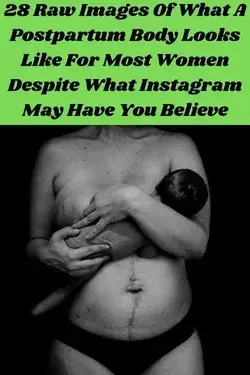 28 Raw Images Of What A Postpartum Body Looks Like For Most Women Despite What Instagram May Have
