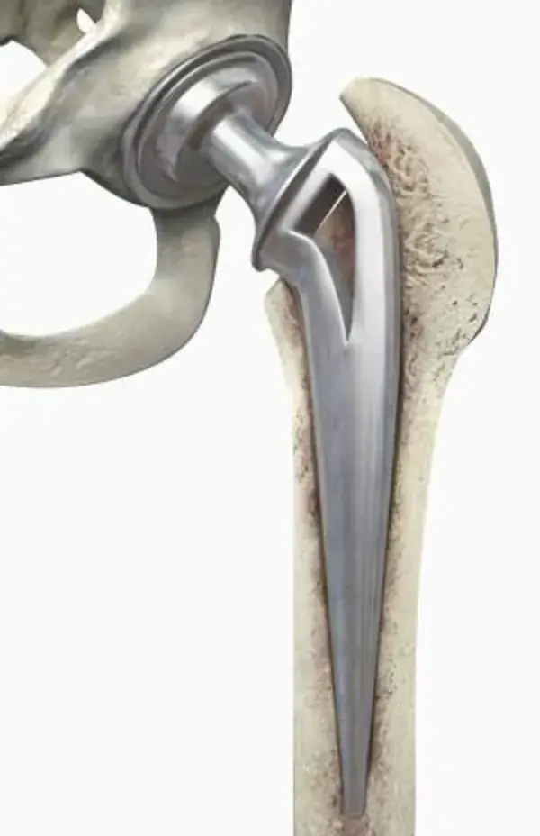 orthopedics.about.com