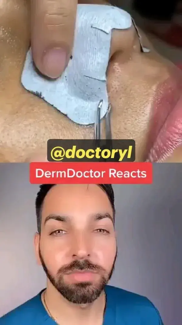 How Pores get cured?🧐🧐