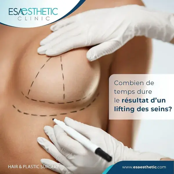 Combien de temps dure le résultat d'un lifting des seins?