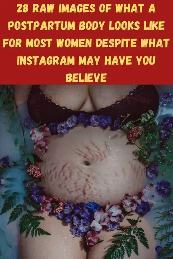 28 Raw Images Of What A Postpartum Body Looks Like For Most Women Despite...