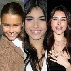 Madison Beer before surgery