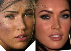 Megan Fox: Before & After Surgery