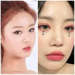 Soojin eyes cirugy and botox