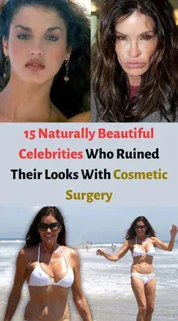 15 Naturally Beautiful Celebrities Who Ruined Their Looks With Cosmetic Surgery