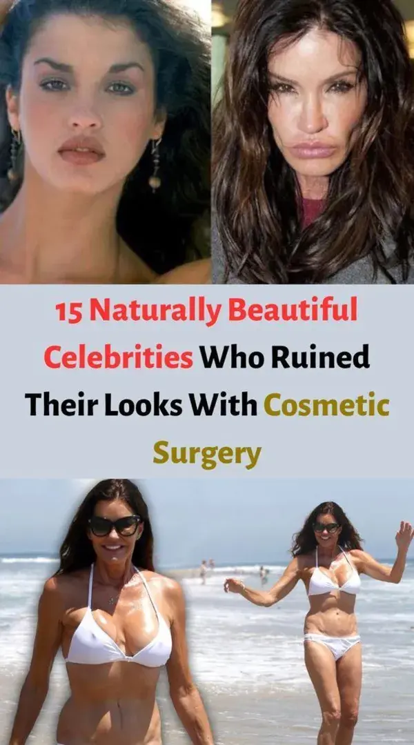 15 Naturally Beautiful Celebrities Who Ruined Their Looks With Cosmetic Surgery