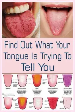 Check ur tongue