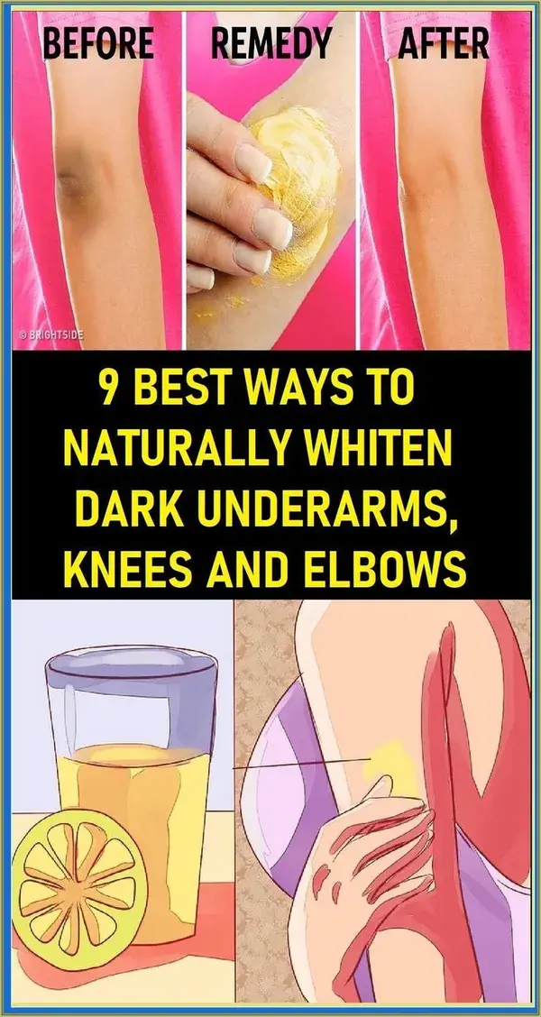 9 BEST WAYS TO NATURALLY WHITEN DARK UNDERARMS, KNEES AND ELBOWS