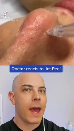 Doctor reacts to the amazing jet peel!