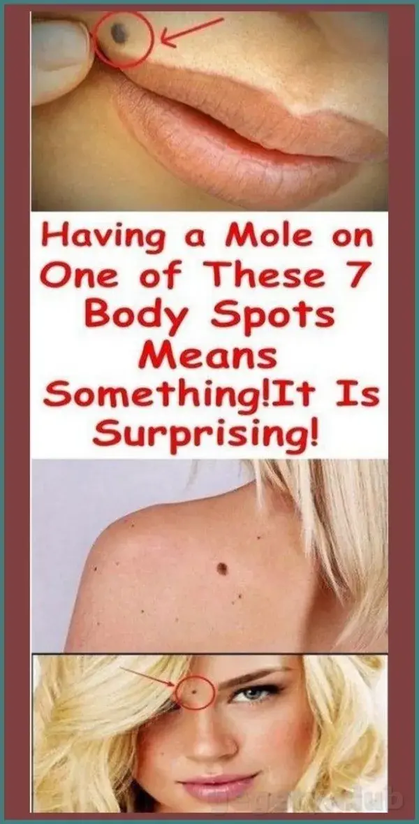 WHAT IT REALLY MEANS IF YOU HAVE A MOLE IN ONE OF THESE PLACES