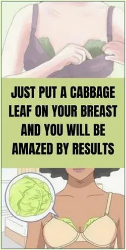 Why Women Put Cabbage Leaves On Their Breasts