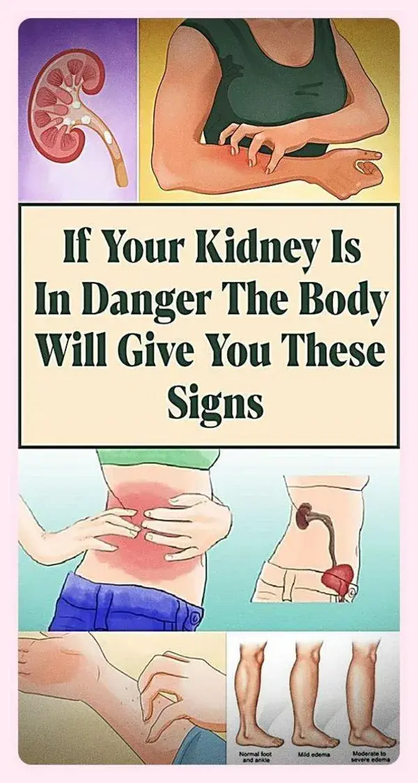 IF YOUR KIDNEY IS IN DANGER, THE BODY WILL GIVE YOU THESE 7 SIGNS
