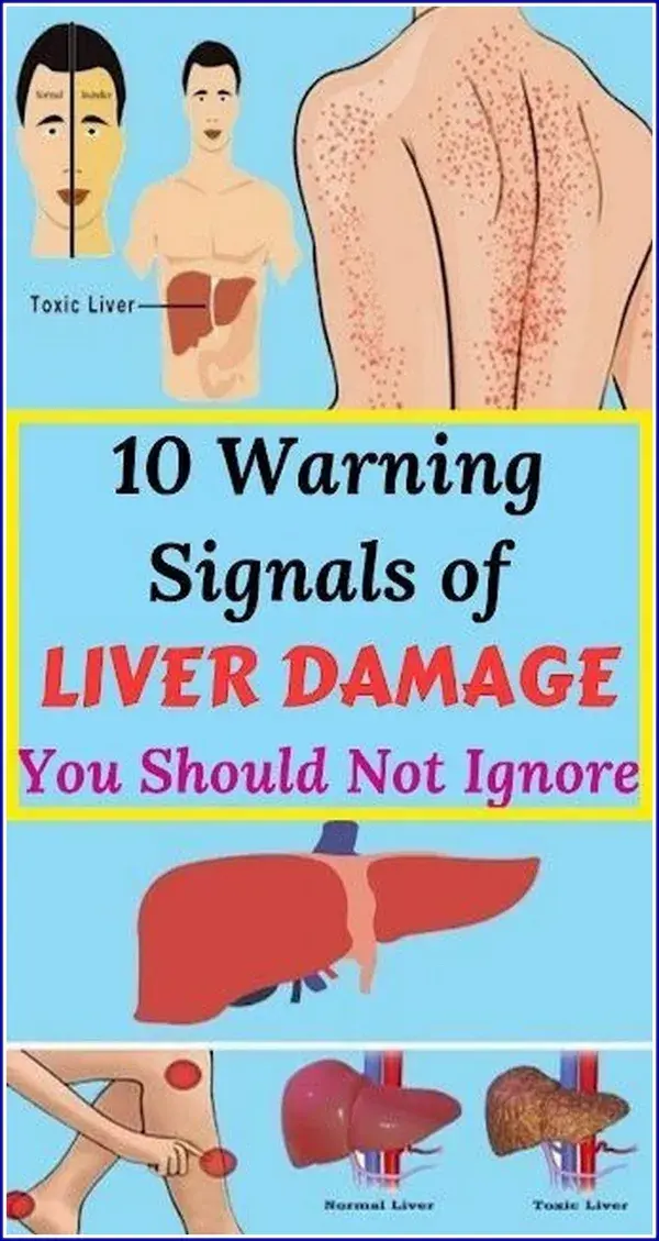 10 Warning Signals of Liver Damage You Should Not Ignore