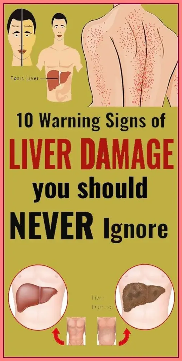 10 Warning Signals of Liver Damage You Should Not Ignore