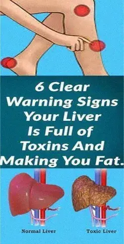 6 Warning Signs That Indicate Your Liver Is Full of Toxins