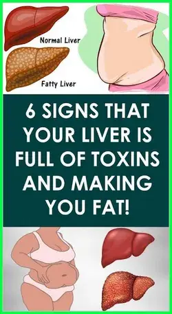 6 Signs That Your Liver is Full of Toxins