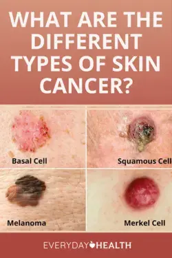 20 Warning Signs that Cancer is Growing in Your Body