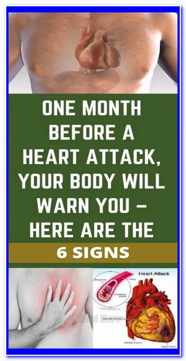 One Month Before a Heart Attack, Your Body Will Warn You � Here are the 6 Signs