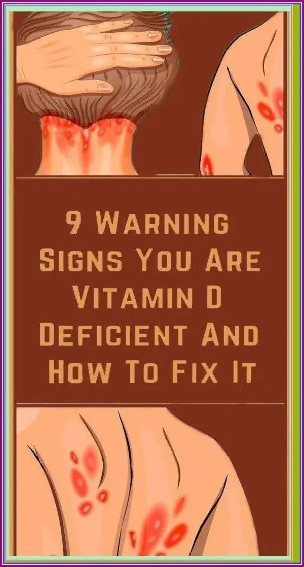 9 Warning Signs You Are Vitamin D Deficient And How To Fix Ita