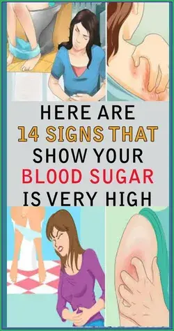 14 Signs Showing That Your Blood Sugar Is Very High