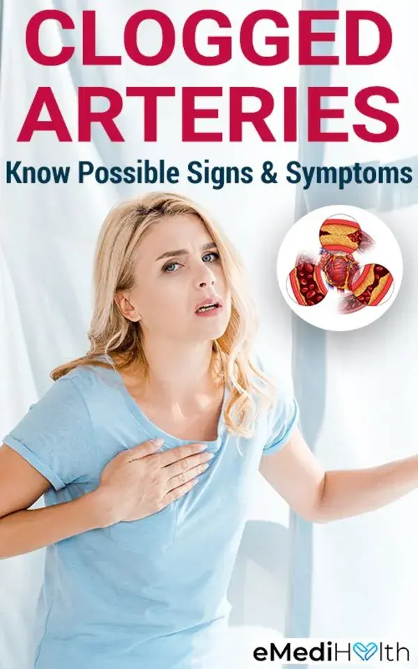 Possible Signs and Symptoms of Clogged Arteries