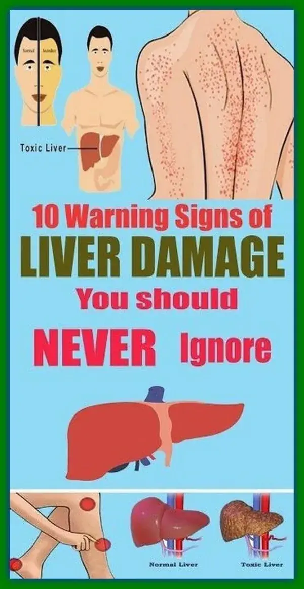 10 Warning Signals of Liver Damage You Should Not Ignore