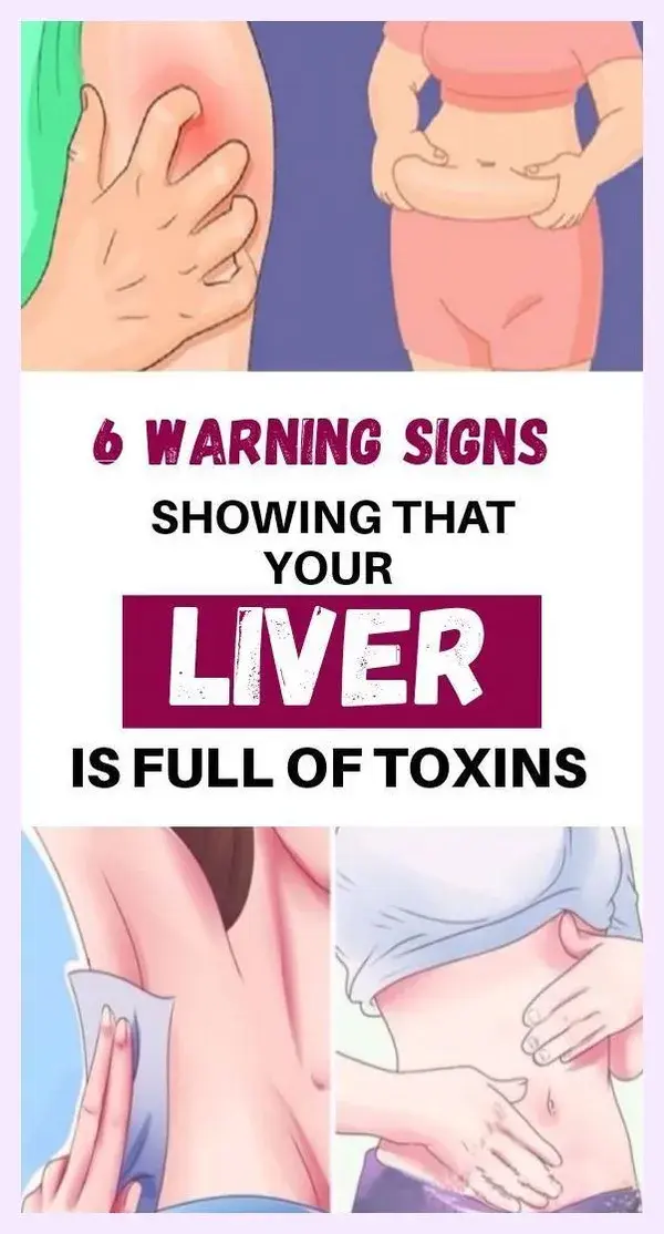 6 Signs That Your Liver Is Full Of Toxins