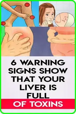 6 Signs That Your Liver is Full of Toxins