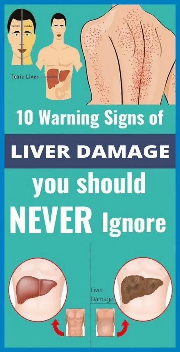 10 Warning Signals of Liver Damage You Should Not Ignore