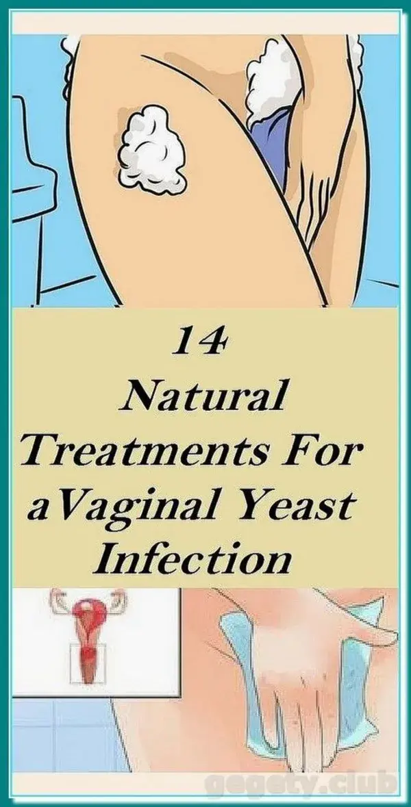 14 NATURAL TREATMENTS FOR A VAGINAL YEAST INFECTION